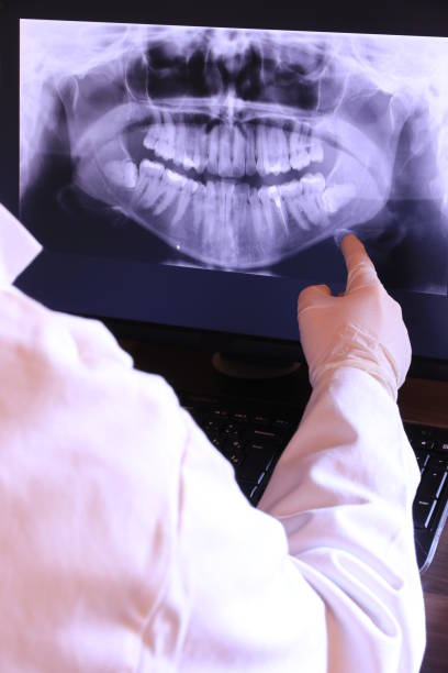 Best Emergency Dental Care for Abscessed Tooth in Iowa Park, TX