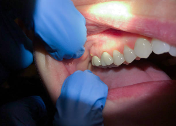 Best Emergency Dental Services for Seniors in Iowa Park, TX