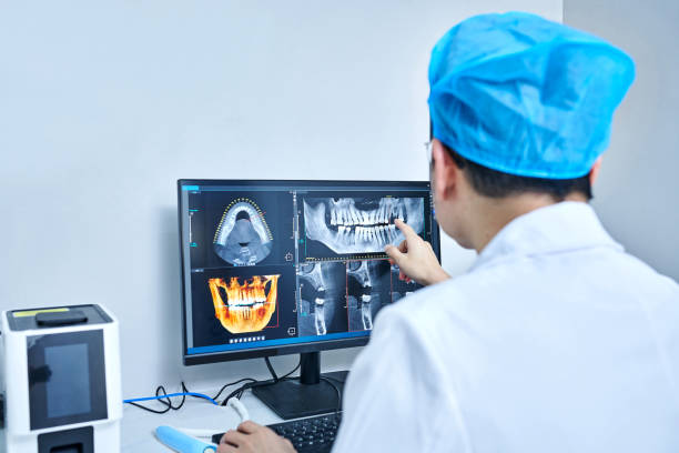 Best Emergency Dentist for Lost Fillings or Crowns in Iowa Park, TX